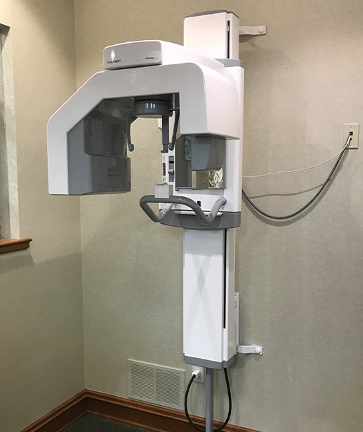 3 D C T cone beam digital x-ray scanner