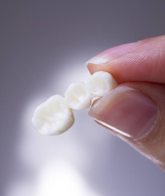 Hand holding a ceramic dental bridge