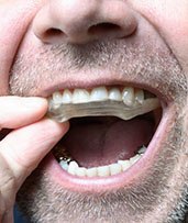 Closeup of man with dental implants in Pewaukee wearing a mouthguard