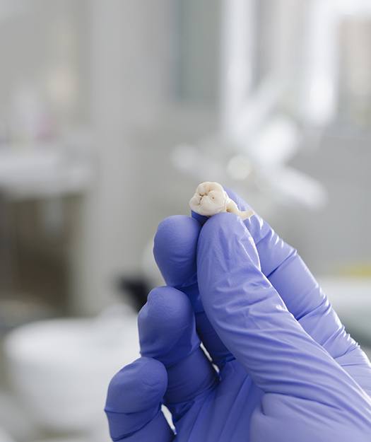 Hand holding an extracted tooth