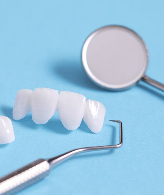 Veneers on table with dental tools